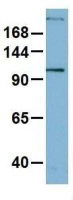 Western Blot: Myosin heavy chain 1 Antibody [NBP1-57681] - Human OVCAR-3.