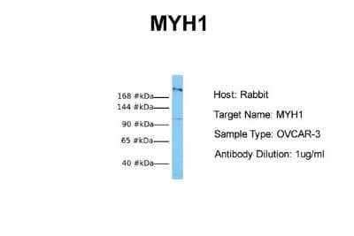 Western Blot: Myosin heavy chain 1 Antibody [NBP1-57681] - Sample Tissue: Human OVCAR-3 Antibody Dilution: 1.0 ug/ml