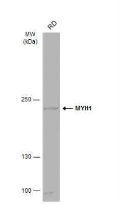 Western Blot: Myosin heavy chain 1 Antibody [NBP2-15029] - Whole cell extract (30 ug) was separated by 5% SDS-PAGE, and the membrane was blotted with MYH1 antibody [N1], N-term diluted at 1:500. The HRP-conjugated anti-rabbit IgG antibody (NBP2-19301) was used to detect the primary antibody.