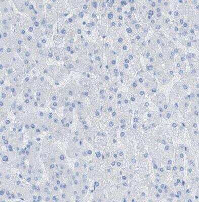 Immunohistochemistry-Paraffin: Myosin heavy chain 11 Antibody [NBP1-87025] - Staining of human liver shows no postivity in hepatocytes as expected.