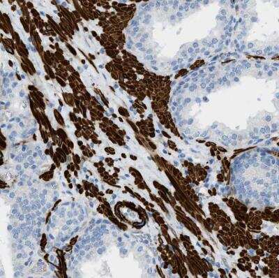 Immunohistochemistry-Paraffin: Myosin heavy chain 11 Antibody [NBP1-87025] - Staining of human prostate shows very strong cytoplasmic postivity in smooth muscle cells.