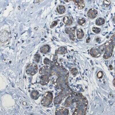 Immunohistochemistry-Paraffin: Myosin heavy chain 11 Antibody [NBP1-87026] - Staining of human breast shows moderate positivity in myoepithelial cells.