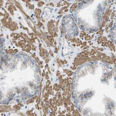 Immunohistochemistry-Paraffin: Myosin heavy chain 11 Antibody [NBP1-87026] - Staining of human prostate shows high expression.