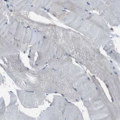 Immunohistochemistry-Paraffin: Myosin heavy chain 11 Antibody [NBP1-87026] - Staining of human skeletal muscle shows low expression as expected.