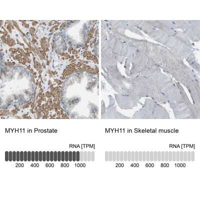 <b>Orthogonal Strategies Validation. </b>Immunohistochemistry-Paraffin: Myosin heavy chain 11 Antibody [NBP1-87026] - Staining in human prostate and skeletal muscle tissues using anti-MYH11 antibody. Corresponding MYH11 RNA-seq data are presented for the same tissues.