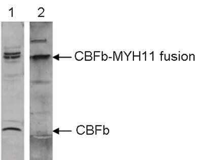 Western Blot: Myosin heavy chain 11 Antibody [NBP2-59221] - Nuclear extracts of ME-1 cells were analysed by Western blot using the antibodies against CBFb and MYH11 diluted 1:1,000 in TBS-Tween containing 5% skimmed milk. The position of the CBFb and CBFb-MYH11 fusion proteins is indicated on the right.