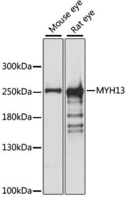 Western Blot: Myosin heavy chain 13 Antibody [NBP3-05614] - Western blot analysis of extracts of various cell lines, using Myosin heavy chain 13 antibody (NBP3-05614) at 1:1000 dilution. Secondary antibody: HRP Goat Anti-Rabbit IgG (H+L) at 1:10000 dilution. Lysates/proteins: 25ug per lane. Blocking buffer: 3% nonfat dry milk in TBST. Detection: ECL Basic Kit. Exposure time: 10s.