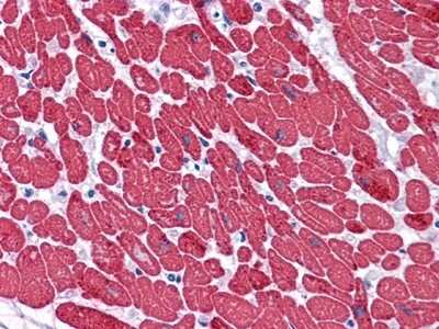 Immunohistochemistry-Paraffin: Myosin light chain 3 Antibody (3F8) [NBP1-51568] - Immunohistochemical analysis of paraffin-embedded human Heart tissues using MYL3 mouse mAb.