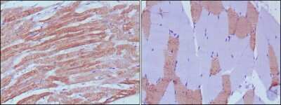 Immunohistochemistry-Paraffin: Myosin light chain 3 Antibody (7C1) [NBP1-51569] - Immunohistochemical analysis of paraffin-embedded human skeletal muscle (left) and cardiac muscle (right) using MYL3 mouse mAb with DAB staining.