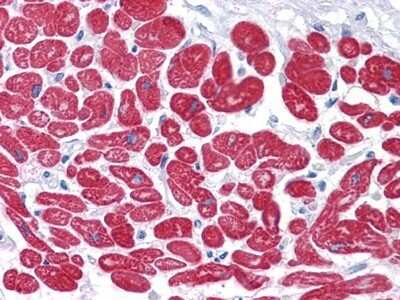 Immunohistochemistry-Paraffin: Myosin light chain 3 Antibody (7C1) [NBP1-51569] - Immunohistochemical analysis of paraffin-embedded human Heart tissues using MYL3 mouse mAb.