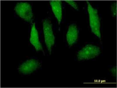 Immunocytochemistry/Immunofluorescence: Myotrophin Antibody (1F3) [H00136319-M14] - Analysis of monoclonal antibody to MTPN on HeLa cell. Antibody concentration 10 ug/ml