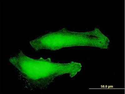 Immunocytochemistry/Immunofluorescence: Myotrophin Antibody [H00136319-B03P] - Analysis of purified antibody to MTPN on HeLa cell. Antibody concentration 10 ug/ml