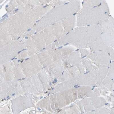 Immunohistochemistry-Paraffin: Myotrophin Antibody [NBP1-89787] - Staining of human skeletal muscle shows no positivity in myocytes as expected.