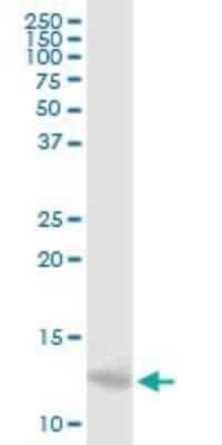 Western Blot Myotrophin Antibody - Azide and BSA Free