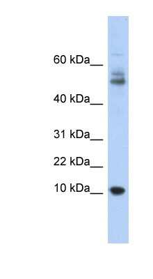 Western Blot: Myotrophin Antibody [NBP1-54959] - Titration: 0.2-1 ug/ml, Positive Control: Human Thymus.