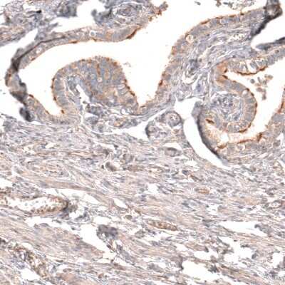 Immunohistochemistry-Paraffin: Myotubularin Antibody [NBP1-86113] - Staining of human fallopian tube shows moderate to strong membranous positivity in subsets of glandular cells.