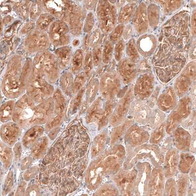 Immunohistochemistry-Paraffin: Myotubularin Antibody [NBP1-86113] - Staining of human kidney shows moderate to strong cytoplasmic positivity in cells in tubules.