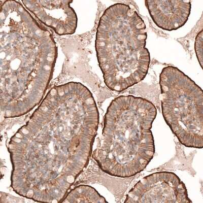 Immunohistochemistry-Paraffin: Myotubularin Antibody [NBP1-86113] - Staining of human small intestine shows moderate to strong membranous positivity in glandular cells.