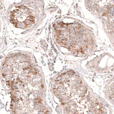 Immunohistochemistry-Paraffin: Myotubularin Antibody [NBP1-86113] - Staining of human testis shows moderate to strong cytoplasmic positivity in subsets of cells in seminiferous ducts.