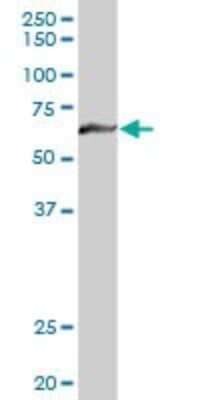 Western Blot: Myotubularin Antibody [H00004534-D01P] - Analysis of MTM1 expression in human liver.