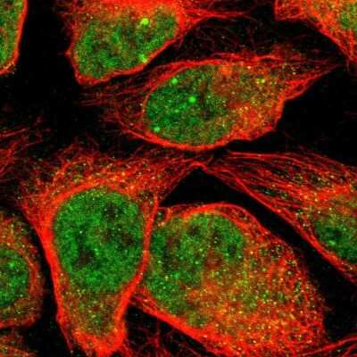 Immunocytochemistry/ Immunofluorescence Myotubularin Related Protein 10 Antibody - BSA Free