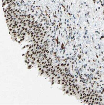 Immunohistochemistry Myotubularin Related Protein 10 Antibody - BSA Free