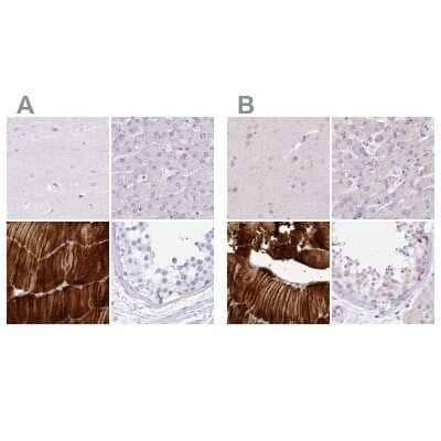 Immunohistochemistry-Paraffin: Myozenin 1 Antibody [NBP1-85439] - Staining of human cerebral cortex, liver, skeletal muscle and testis using Anti-MYOZ1 antibody NBP1-85439 (A) shows similar protein distribution across tissues to independent antibody NBP2-38412 (B).