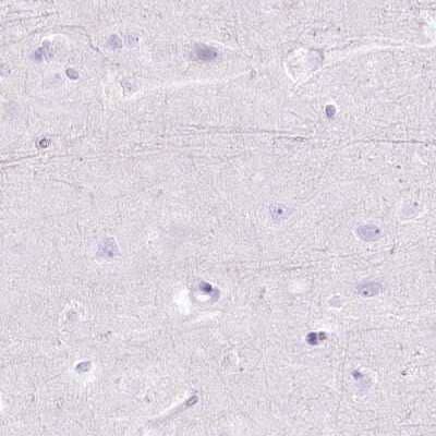 Immunohistochemistry-Paraffin: Myozenin 1 Antibody [NBP1-85439] - Staining of human cerebral cortex.