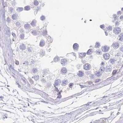 Immunohistochemistry-Paraffin: Myozenin 1 Antibody [NBP1-85439] - Staining of human testis.