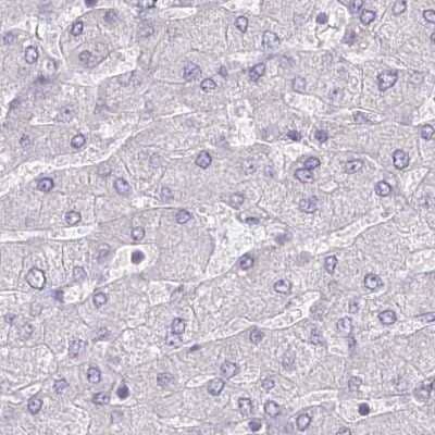 Immunohistochemistry-Paraffin: Myozenin 1 Antibody [NBP1-85439] - Staining of human liver.