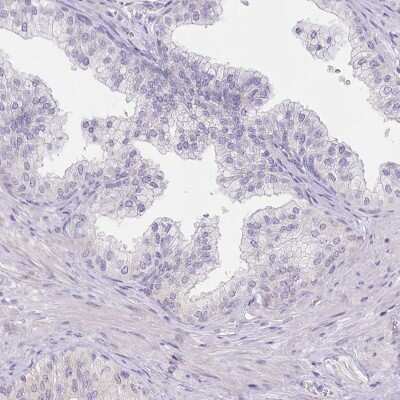 Immunohistochemistry-Paraffin: Myozenin 1 Antibody [NBP2-38412] - Staining of human prostate shows low expression as expected.