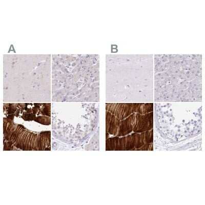 <b>Independent Antibodies Validation and Orthogonal Strategies Validation.</b>Immunohistochemistry-Paraffin: Myozenin 1 Antibody [NBP2-38412] - Staining of human cerebral cortex, liver, skeletal muscle and testis using Anti-MYOZ1 antibody NBP2-38412 (A) shows similar protein distribution across tissues to independent antibody NBP1-85439 (B).