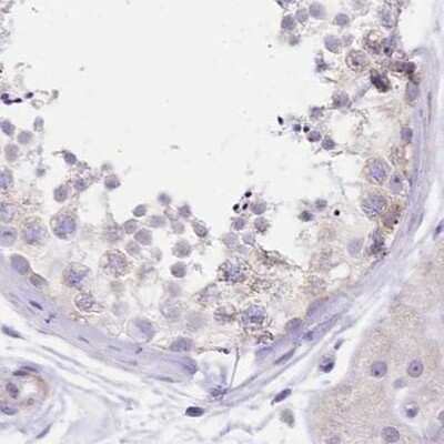 Immunohistochemistry-Paraffin: Myozenin 1 Antibody [NBP2-38412] - Staining of human testis.