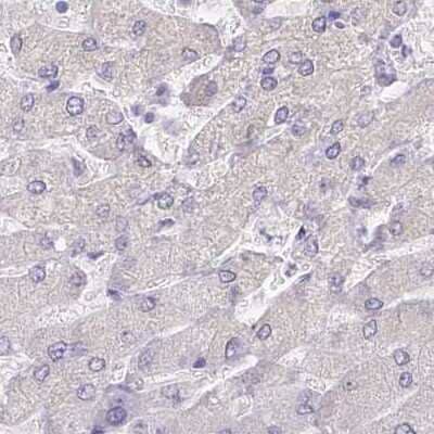 Immunohistochemistry-Paraffin: Myozenin 1 Antibody [NBP2-38412] - Staining of human liver.