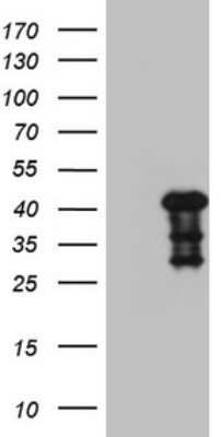 Western Blot: Myozenin 1 Antibody (OTI4C2) - Azide and BSA Free [NBP2-72865] - Analysis of HEK293T cells were transfected with the pCMV6-ENTRY control (Left lane) or pCMV6-ENTRY Myozenin 1.