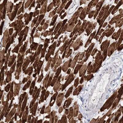 Immunohistochemistry-Paraffin Myozenin 2 Antibody