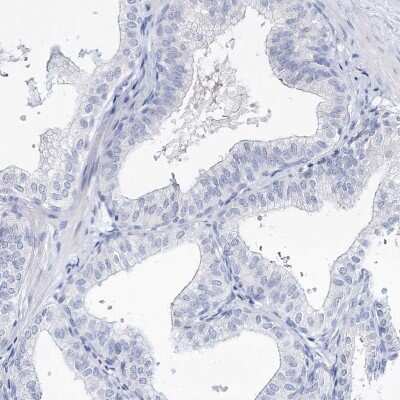 Immunohistochemistry-Paraffin Myozenin 2 Antibody