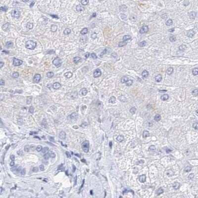Immunohistochemistry-Paraffin: Myozenin 2 Antibody [NBP1-88259] - Staining of human liver.