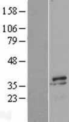 Western Blot: Myozenin 2 Overexpression Lysate (Adult Normal) [NBL1-13447] Left-Empty vector transfected control cell lysate (HEK293 cell lysate); Right -Over-expression Lysate for Myozenin 2.