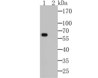 Western Blot: Myrosinase 2 Antibody (6H1) [NBP2-89159] - Analysis of TGG2 on Arabidopsis thaliana lysates. Positive control: Lane 1: Anti-TGG2 antibody, 1/1,000 dilution. Lane 2: Anti-TGG2 antibody, preincubated with the control peptide antigen.