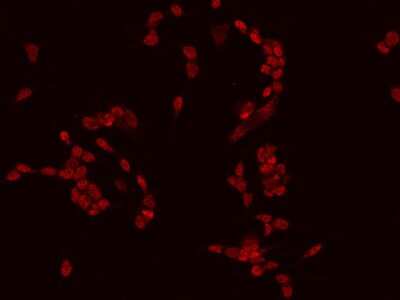 Immunocytochemistry/Immunofluorescence: Myt1 Antibody [NBP2-97801] - Immunofluorescence staining of Myt1 in SHSY5Y cells. Cells were fixed with 4% PFA, permeabilzed with 0.1% Triton X-100 in PBS, blocked with 10% serum, and incubated with rabbit anti-Human Myt1 polyclonal antibody (dilution ratio 1:200) at 4C overnight. Then cells were stained with the Alexa Fluor(R)594-conjugated Goat Anti-rabbit IgG secondary antibody (red). Positive staining was localized to Nucleus.