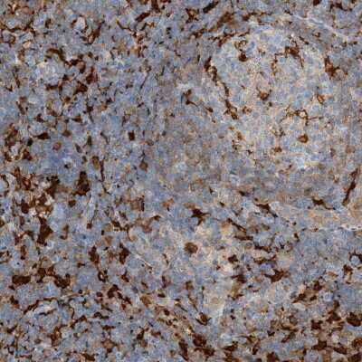 Immunohistochemistry: N-Acetyl-D-Glucosamine Kinase/NAGK Antibody [NBP2-38240] - Staining of human lymph node shows strong cytoplasmic positivity in subsets of cells.