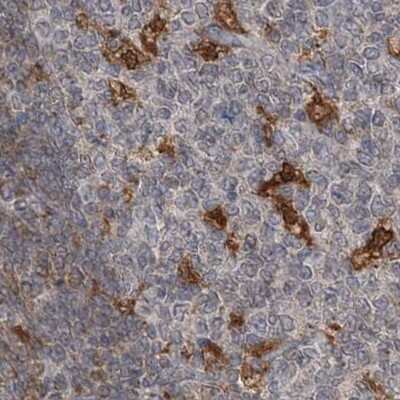 Immunohistochemistry-Paraffin: N-Acetyl-D-Glucosamine Kinase/NAGK Antibody [NBP1-89750] - Staining of human tonsil.