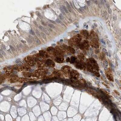 Immunohistochemistry-Paraffin: N-Acetyl-D-Glucosamine Kinase/NAGK Antibody [NBP1-89750] - Staining of human colon.