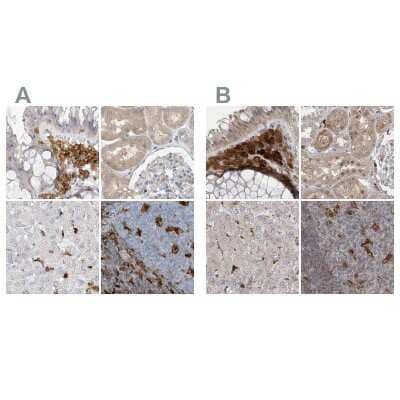 <b>Independent Antibodies Validation. </b>Immunohistochemistry-Paraffin: N-Acetyl-D-Glucosamine Kinase/NAGK Antibody [NBP2-38240] - Staining of human colon, kidney, liver and tonsil using Anti-NAGK antibody NBP2-38240 (A) shows similar protein distribution across tissues to independent antibody NBP1-89750 (B).