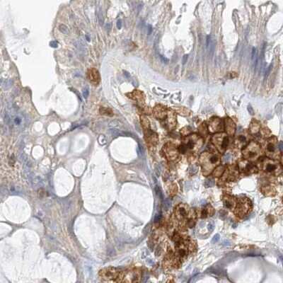 Immunohistochemistry-Paraffin: N-Acetyl-D-Glucosamine Kinase/NAGK Antibody [NBP2-38240] - Staining of human colon.