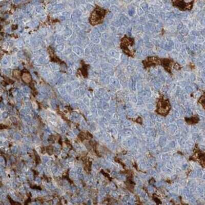 Immunohistochemistry-Paraffin: N-Acetyl-D-Glucosamine Kinase/NAGK Antibody [NBP2-38240] - Staining of human tonsil.