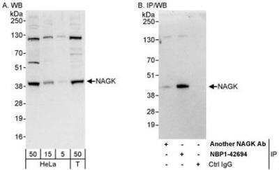 Western Blot: N-Acetyl-D-Glucosamine Kinase/NAGK Antibody [NBP1-42694] - Whole cell lysate from HeLa (5, 15 and 50 mcg for WB; 1 mg for IP, 20% of IP loaded) and 293T (T; 50 mcg) cells.  Antibodies: Affinity purified rabbit anti-NAGK antibody used for WB at 0.4 mcg/ml (A) and 1 mcg/ml (B) and used for IP at 3 mcg/mg lysate.  NAGK was also immunoprecipitated by another rabbit anti-NAGK antibody, which recognizes an upstream epitope.