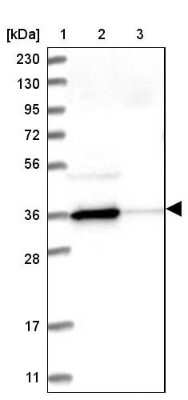 Western Blot N-Acetyl-D-Glucosamine Kinase/NAGK Antibody - BSA Free