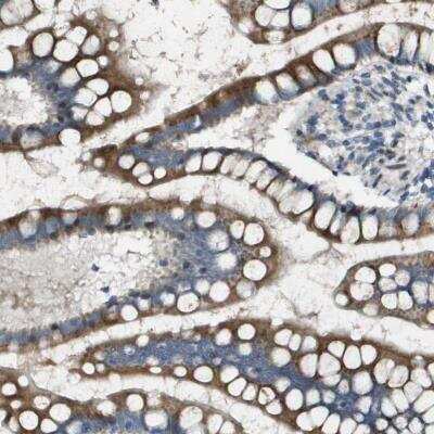 Immunohistochemistry-Paraffin: N-Acetylglucosaminyltransferase III/MGAT3 Antibody [NBP1-81810] - Staining of human small intestine shows strong cytoplasmic positivity in glandular cells.
